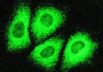 丙型肝炎病毒 丙型肝炎病毒