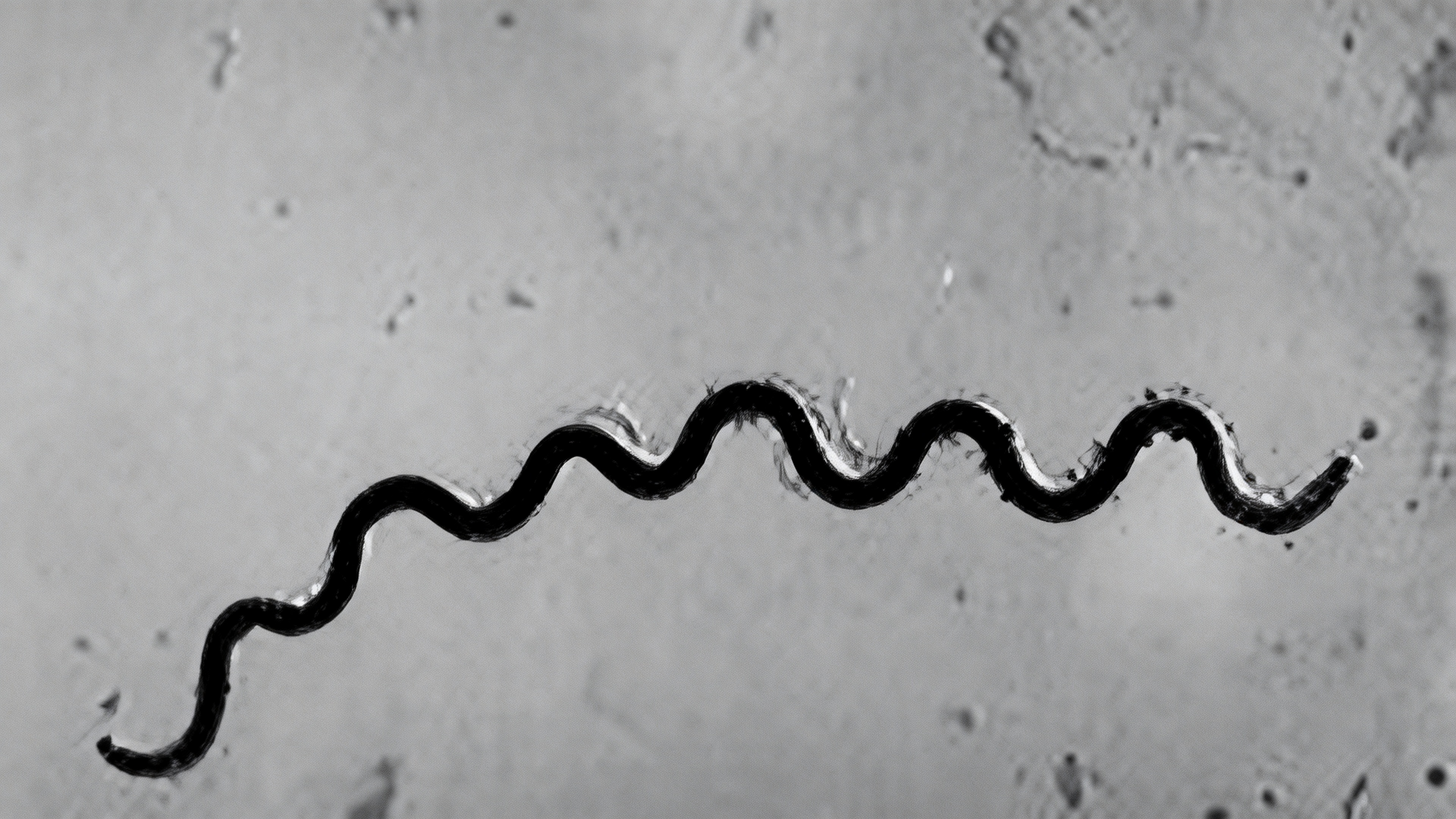 梅毒螺旋体 梅毒螺旋体