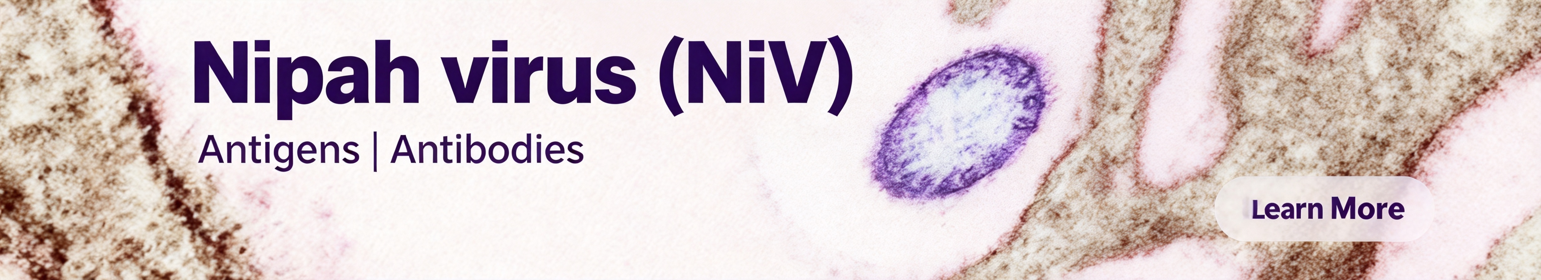 尼帕病毒 (NiV) 尼帕病毒 (NiV)