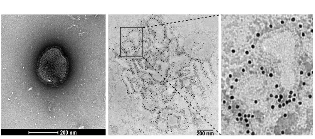 人偏肺病毒 (HMPV)