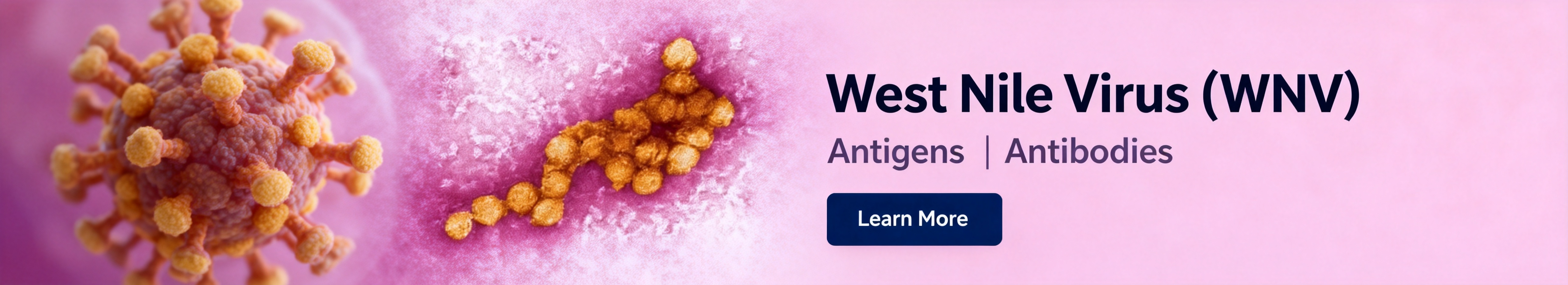西尼罗病毒 (WNV)