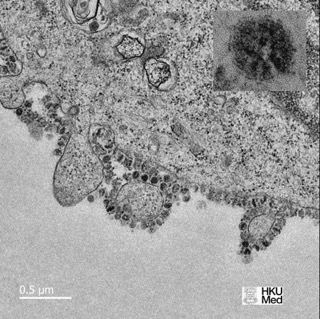 中东呼吸综合征冠状病毒 中东呼吸综合征冠状病毒